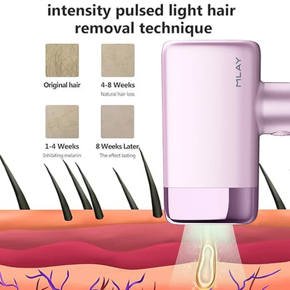 MLAY T14 IPL ICE Cooling IPL Laser Epilator Home Hair Removal Device Replaceable Face Body Bikini Lamps For Women Men Painless