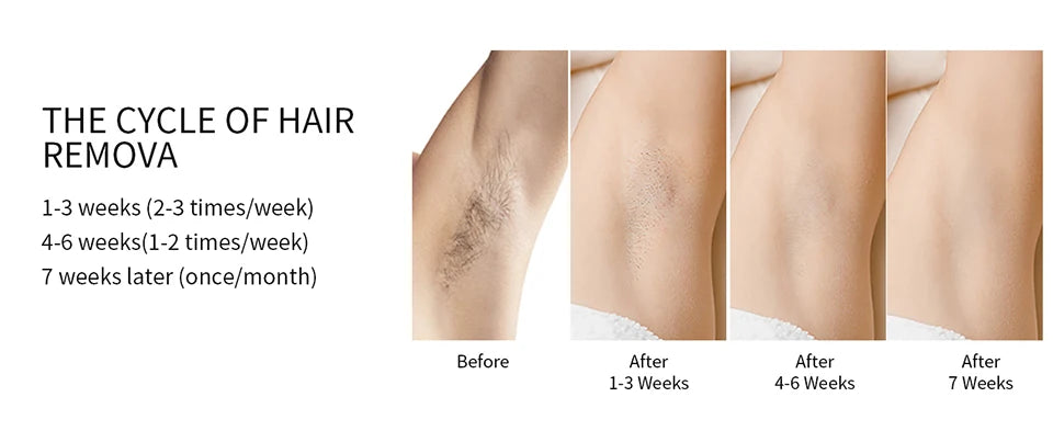MLAY T14 IPL ICE Cooling IPL Laser Epilator Home Hair Removal Device Replaceable Face Body Bikini Lamps For Women Men Painless